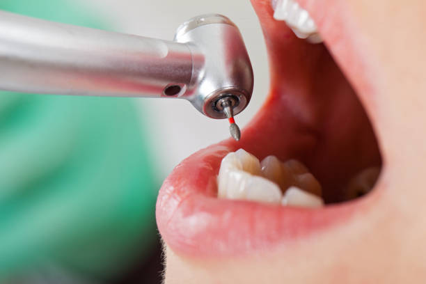 Best Same-Day Emergency Dental Services in Lucedale, MS